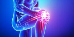أفضل أطباء استبدال مفصل الركبة بأبوظبي – موقع كيف