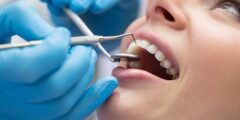 أفضل أطباء الأسنان في مكة – موقع كيف