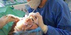 أفضل أطباء جراحة الوجه والفكين في مكة – موقع كيف