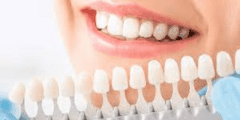 أفضل أطباء زراعة الأسنان بالرياض – موقع كيف