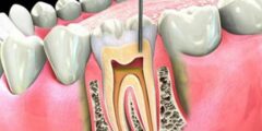 أفضل دكتور اسنان عربي في هاغن – تجارب الوسام