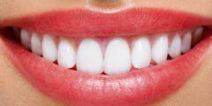 أفضل دكتور اسنان في دورتموند – تجارب الوسام