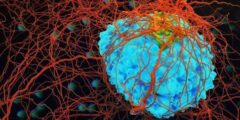 أقراص سبرايسل Sprycel لتقليل انتشار الخلايا السرطانية – شبكة سيناء