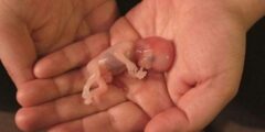 تفسير حلم الإجهاض للحامل - شقاوة