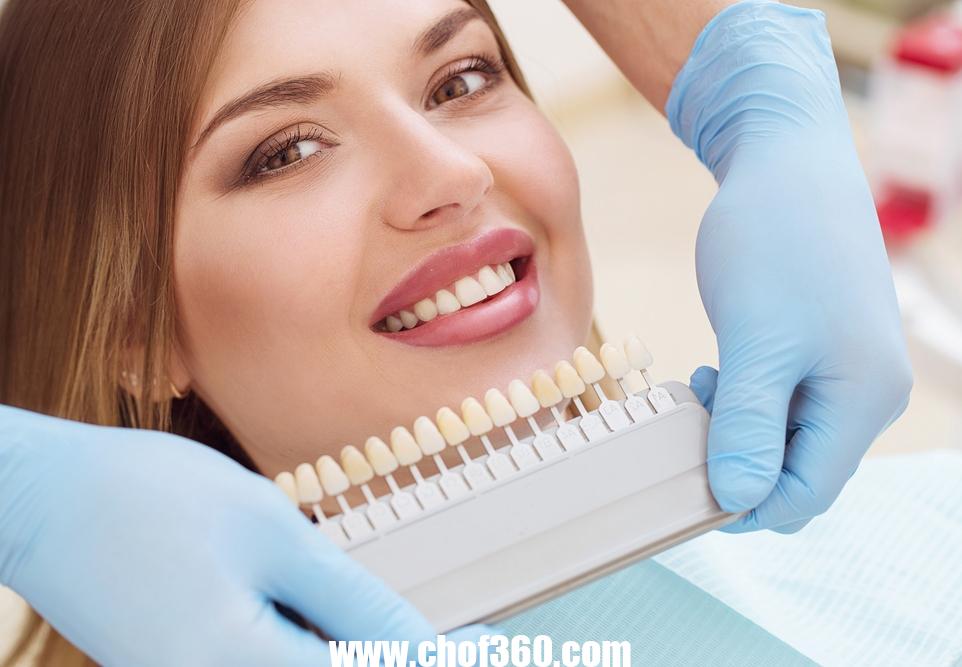 تكلفة عملية تلبيس الأسنان الأمامية – موقع كيف