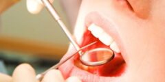 ما هي أقوى الطرق لتخفيف آلام الأسنان – موقع كيف