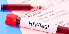 هل تحليل الدم الشامل يكشف الإيدز التحليل الشامل – موقع كيف
